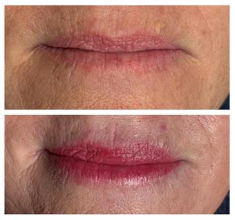Lip Maintenance