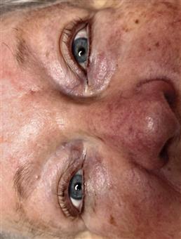 Lower Lash Enhancement