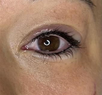 Lower Lash Enhancement Maintenance