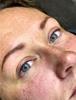 Upper Lash Enhancement Maintenance