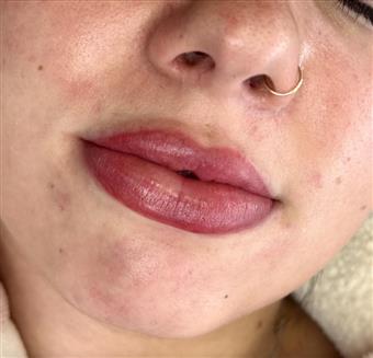 Lip Touch-up